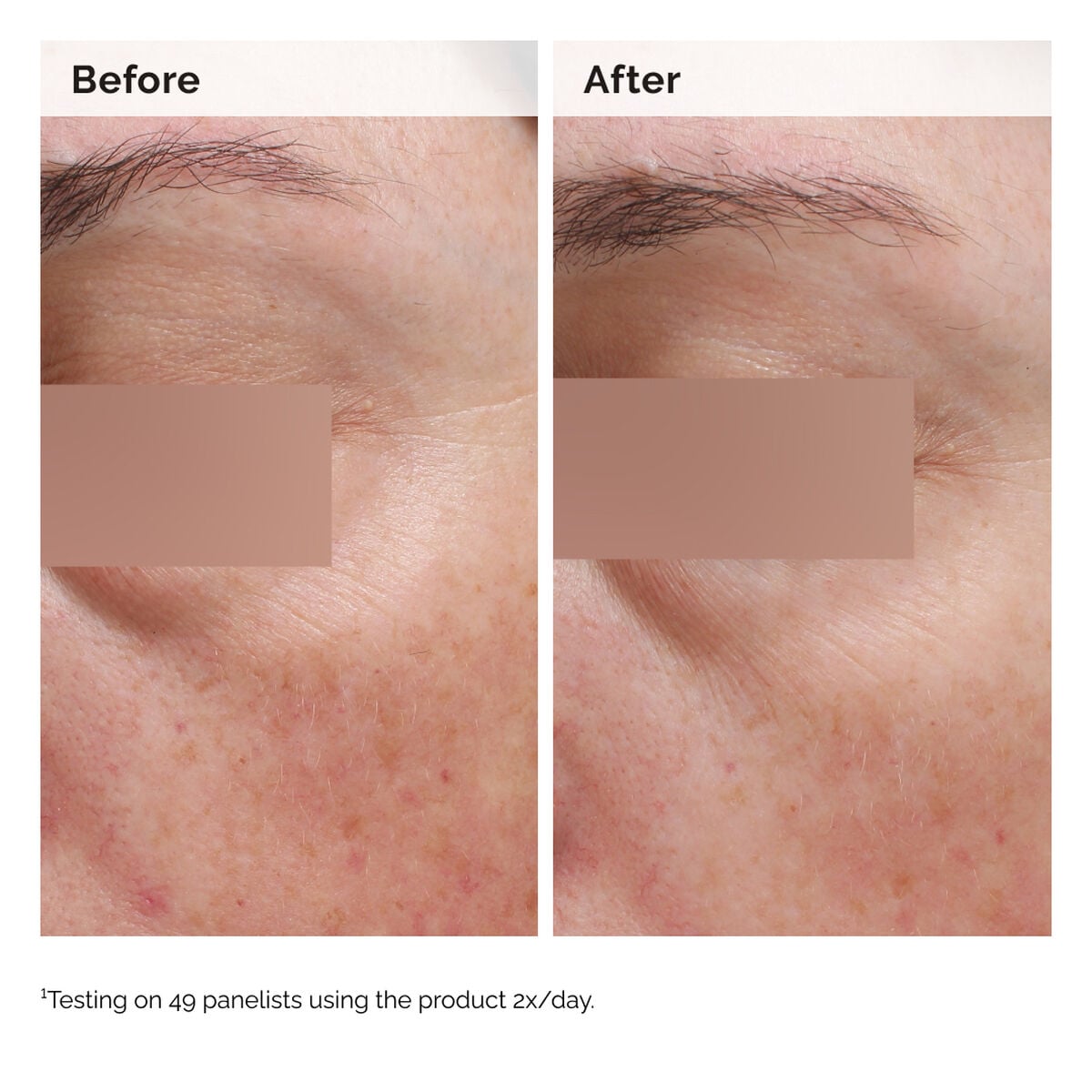 niacinamide-5-face-and-body-emulsion-b2 2024-08-23-ORD-Nia-5pct-Face-Body-B-A-Elasticity-Global-02-1x1.jpg
