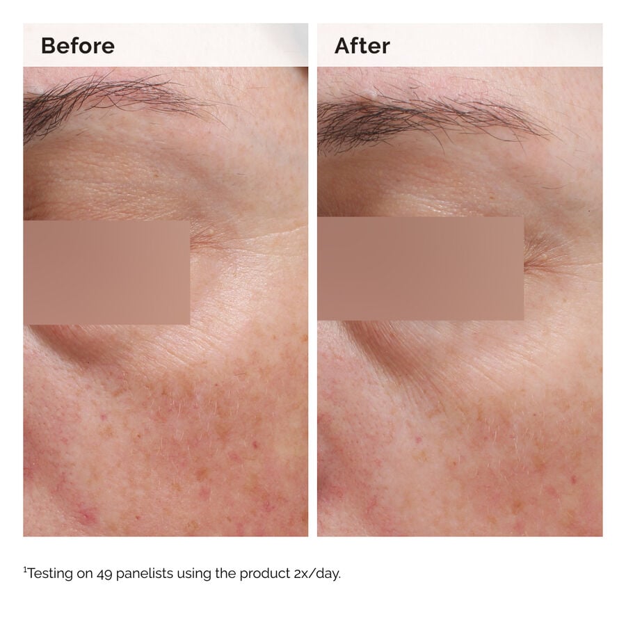 niacinamide-5-face-and-body-emulsion-b2 2024-08-23-ORD-Nia-5pct-Face-Body-B-A-Elasticity-Global-02-1x1.jpg