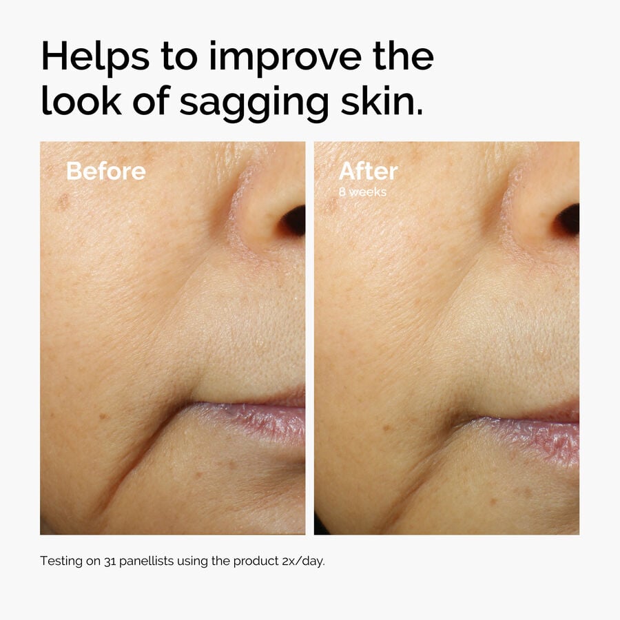 caffeine-3-escin-1-face-serum-b3 ord-caffeine-3pct-escin-1pct-face-serum-before-after-sagging.jpg