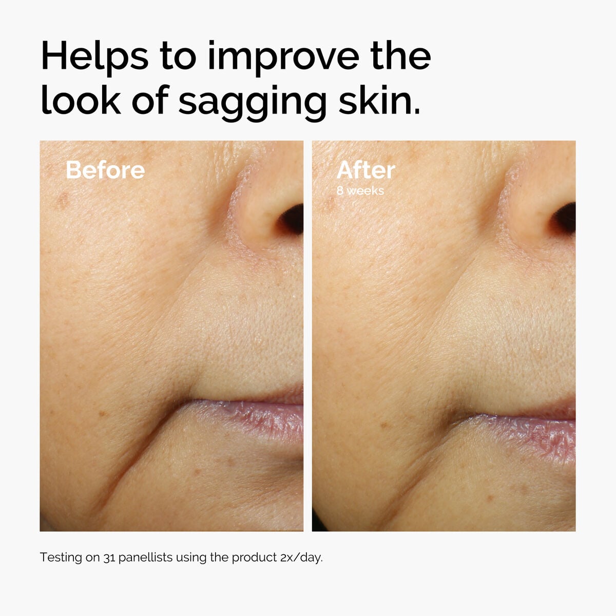 caffeine-3-escin-1-face-serum-b3 ord-caffeine-3pct-escin-1pct-face-serum-before-after-sagging.jpg