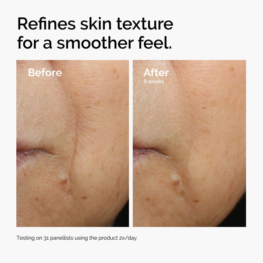 caffeine-3-escin-1-face-serum-b3 ord-caffeine-3pct-escin-1pct-face-serum-before-after-texture.jpg