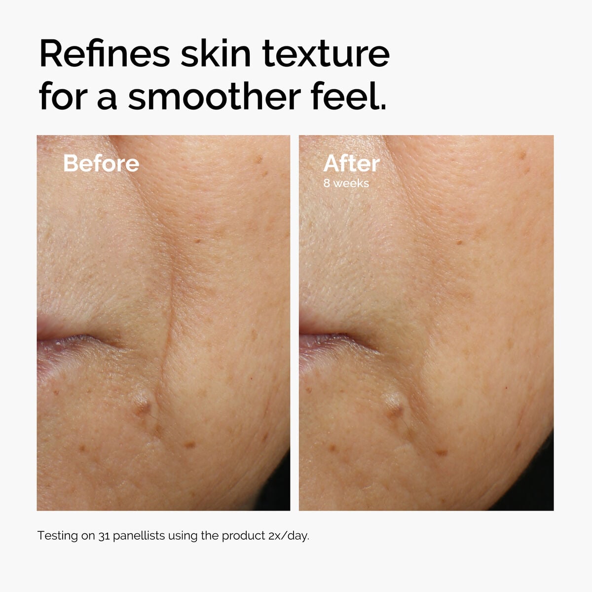 caffeine-3-escin-1-face-serum-b3 ord-caffeine-3pct-escin-1pct-face-serum-before-after-texture.jpg