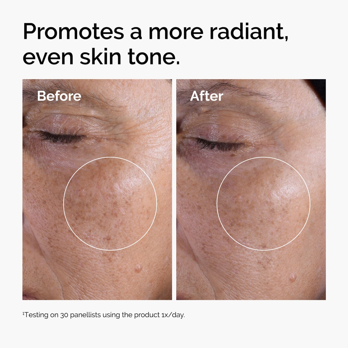 glycolic-acid-7-exfoliating-toner-t9 ord-glycolic-before-after-radiance.jpg