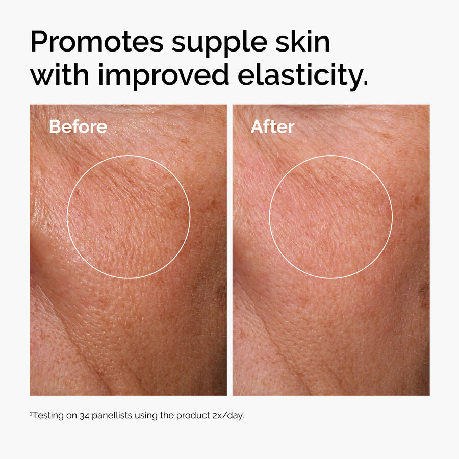 hyaluronic-acid-2-b5-with-ceramides-f2 ord-hyaluronic-acid-2pct-b5-hydrating-serum-before-after-elasticity.jpg