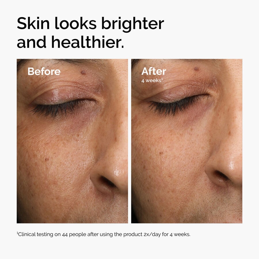 multi-antioxidant-radiance-serum-l2 ord-mars-before-after-healthy.jpg