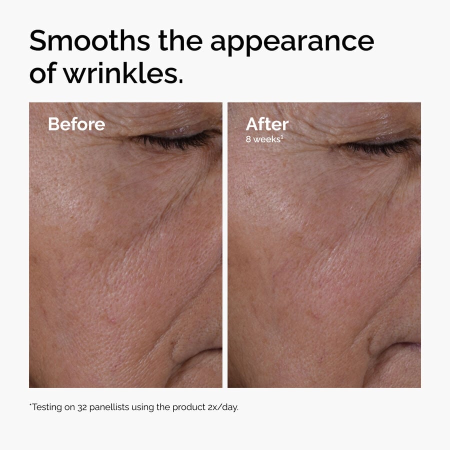 multi-peptide-ha-serum-r6 ord-multi-peptide-ha-serum-wrinkles-before-after.jpg