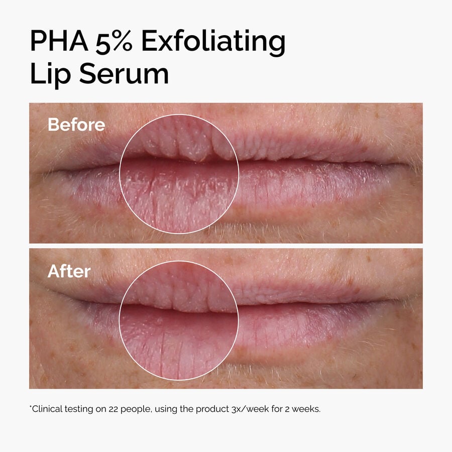 pha-5-exfoliating-lip-serum-j9 ord-pha-5pct-lip-exfoliating-serum-before-after.jpg