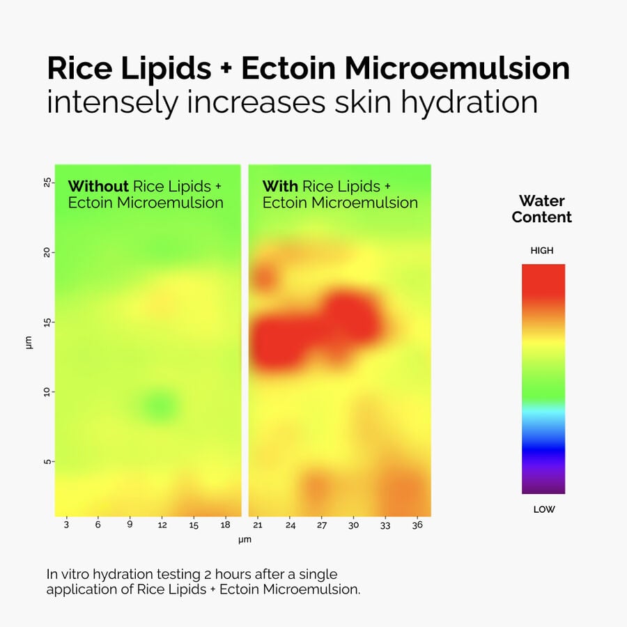 rice-lipids-ectoin-microemulsion-p6 ord-rice-lipids-ectoin-microemulsion-thermal-before-after.jpg