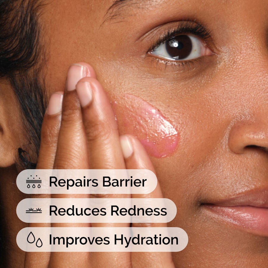 soothing-and-barrier-support-serum-set-r5 ord-soothing-barrier-support-serum-model-application-with-benefits.jpg