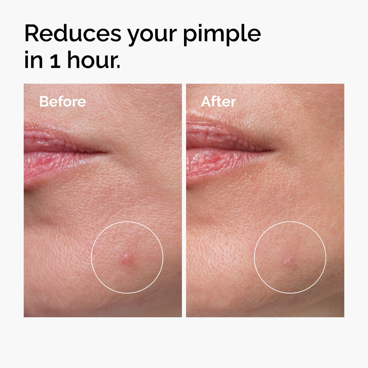 sulfur-10-powder-to-cream-concentrate-y0 ord-sulfur-10pct-powder-to-cream-concentrate-before-after-NA.jpg