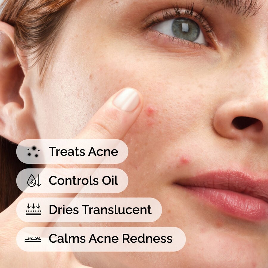 sulfur-10-powder-to-cream-concentrate-y0 ord-sulfur-10pct-powder-to-cream-concentrate-model-application-with-benefits-acne.jpg